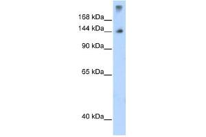 WB Suggested Anti-SF3B1 Antibody Titration:  1. (SF3B1 Antikörper  (N-Term))