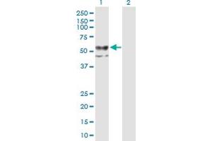 Western Blot analysis of CHST12 expression in transfected 293T cell line by CHST12 MaxPab polyclonal antibody.
