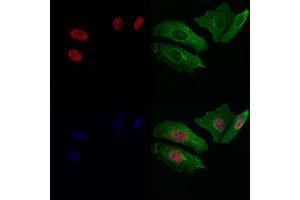 ABIN7093972 and ABIN7098016 staining Hela cells by IF/ICC.