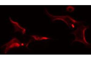 ABIN6274256 staining Hela cells by IF/ICC. (FRK Antikörper  (Internal Region))