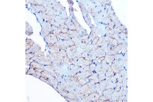 Immunohistochemistry of paraffin-embedded rat heart using Flotillin 1 Rabbit mAb (ABIN3017206, ABIN3017207, ABIN1680028 and ABIN1680029) at dilution of 1:100 (40x lens). (Flotillin 1 Antikörper)