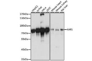 Western blot analysis of extracts of various cell lines, using KARS antibody. (KARS Antikörper  (AA 298-597))