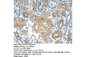 Rabbit Anti-CTDSPL Antibody  Paraffin Embedded Tissue: Human Kidney Cellular Data: Epithelial cells of renal tubule Antibody Concentration: 4. (CTDSPL Antikörper  (N-Term))