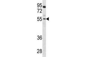 PAX7 antibody western blot analysis in CEM lysate (PAX7 Antikörper  (AA 181-210))