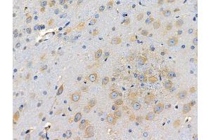 ABIN6257484 and ABIN6274780 at 1/100 staining Rat brain tissue by IHC-P.