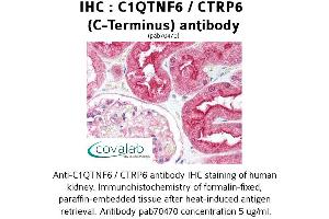 Image no. 2 for anti-Complement C1q Tumor Necrosis Factor-Related Protein 6 (C1QTNF6) antibody (ABIN1732486) (CTRP6 Antikörper)