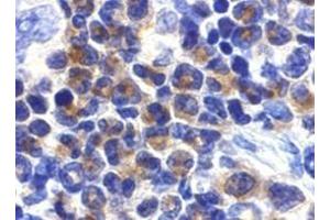 Immunohistochemistry of DAPK2 in mouse spleen cells with DAPK2 antibody at 2 μg/ml. (DAPK2 Antikörper)