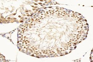 Immunohistochemistry analysis of paraffin-embedded rat testis using,SET (ABIN7075583) at dilution of 1: 10000 (SET/TAF-I Antikörper)