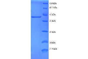 SDS-PAGE (SDS) image for Ribosomal Protein S24 (RPS24) (AA 2-133), (partial) protein (GST tag) (ABIN5712227) (RPS24 Protein (AA 2-133, partial) (GST tag))