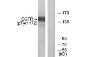 Western blot analysis of extracts from A431 cells treated with EGF 40 muM 10', using EGFR (Phospho-Tyr1172) Antibody. (EGFR Antikörper  (pTyr1172))