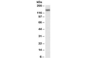 Western blot testing of Jurkat nuclear lysate with NFATC3 antibody at 0.