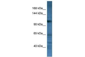 WB Suggested Anti-CD22 Antibody Titration: 0. (CD22 Antikörper  (C-Term))