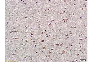Formalin-fixed and paraffin embedded rat brain labeled with Anti- Bax Polyclonal Antibody, Unconjugated (ABIN725375) at 1:200, followed by conjugation to the secondary antibody and DAB staining. (BAX Antikörper  (AA 84-175))