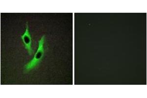 Immunofluorescence analysis of HeLa cells, using STEAP4 Antibody. (STEAP4 Antikörper  (AA 201-250))