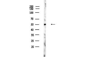 Western blot analysis of lysates from Hela cells(heat-shock,45 min treatment), using Acetyl-alpha-Tubulin (Lys40) Antibody at 1/1000 dilution.