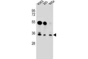 Western Blotting (WB) image for anti-GLI Pathogenesis-Related 1 Like 2 (GLIPR1L2) antibody (ABIN2996840) (GLIPR1L2 Antikörper)
