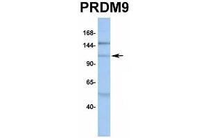 Host:  Rabbit  Target Name:  PRDM9  Sample Type:  MCF7  Antibody Dilution:  1. (PRDM9 Antikörper  (Middle Region))