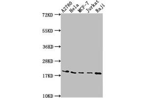 Western Blot Positive WB detected in: A2780 whole cell lysate, Hela whole cell lysate, MCF-7 whole cell lysate, Jurkat whole cell lysate, Raji whole cell lysate All lanes: EIF5A antibody at 1:2000 Secondary Goat polyclonal to rabbit IgG at 1/50000 dilution Predicted band size: 17, 21 kDa Observed band size: 18 kDa (Rekombinanter EIF5A Antikörper)