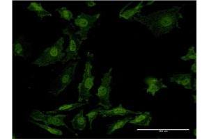 Immunofluorescence of monoclonal antibody to AKT2 on HeLa cell.