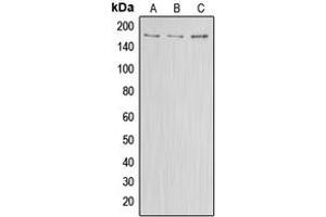 Western blot analysis of ABCA8 expression in HEK293T (A), Raw264. (ABCA8 Antikörper  (Center))