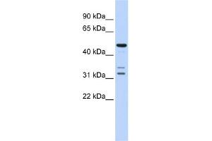 WB Suggested Anti-HTRA4 Antibody Titration: 0. (HTRA4 Antikörper  (Middle Region))