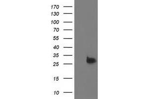 Western Blotting (WB) image for anti-Deoxythymidylate Kinase (Thymidylate Kinase) (DTYMK) antibody (ABIN1497921) (DTYMK Antikörper)