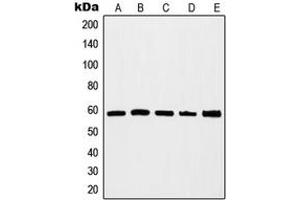Western blot analysis of c-Myc expression in HEK293A (A), Jurkat (B), K562 (C), HeLa (D), NIH3T3 (E) whole cell lysates. (c-MYC Antikörper  (C-Term))