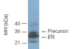 Western blot showing detection of 20S proteasome subunit beta5t in C57/BL6 mouse thymus lysate by  at 1:1000 dilution. (Proteasome 20S Beta5t Subunit Antikörper)