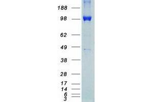Western Blotting (WB) image for Receptor Tyrosine Kinase-Like Orphan Receptor 1 (ROR1) (Transcript Variant 1) protein (Myc-DYKDDDDK Tag) (ABIN2731082)