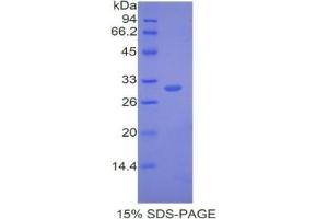 SDS-PAGE analysis of Mouse ATP1b1 Protein. (ATPase, Na+/K+ Transporting, beta 1 Polypeptide (ATP1B1) Peptid)