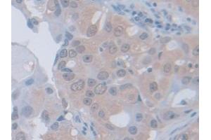 Immunohistochemistry (IHC) image for anti-Phosphoglucomutase 1 (PGM1) (AA 1-235) antibody (ABIN7444190)
