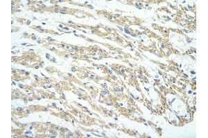 Rabbit Anti-PHF11 antibody         Paraffin Embedded Tissue:  Human Heart    cell Cellular Data:  cardiac cell    Antibody Concentration:  4. (PHF11 Antikörper  (Middle Region))