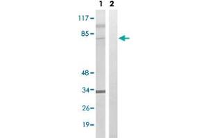 Western blot analysis of Lane 1: Untreated HeLa cell lysates, Lane 2: Synthesized peptide treated HeLa cell lysates reacted with MDM4 (phospho S367) polyclonal antibody  at 1:500-1:3000 dilution. (MDM4-binding Protein Antikörper  (pSer367))