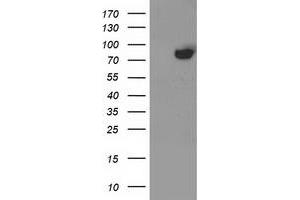 Western Blotting (WB) image for anti-Acyl-CoA Synthetase Short-Chain Family Member 2 (ACSS2) antibody (ABIN1496428) (ACSS2 Antikörper)