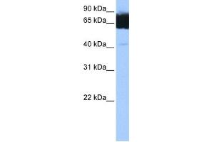 WB Suggested Anti-TTC12 Antibody Titration: 0. (TTC12 Antikörper  (C-Term))