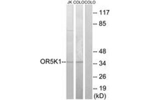 Western blot analysis of extracts from COLO/Jurkat cells, using OR5K1 Antibody. (OR5K1 Antikörper  (AA 56-105))