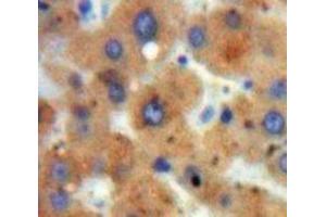 Used in DAB staining on fromalin fixed paraffin-embedded Liver tissue (HDAC6 Antikörper  (AA 1038-1204))