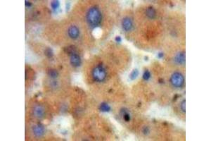 Used in DAB staining on fromalin fixed paraffin-embedded Liver tissue