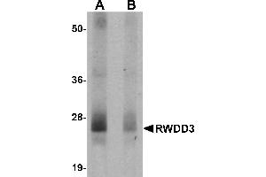 Western blot analysis of RWDD3 in mouse kidney tissue lysate with RWDD3 antibody at 0.