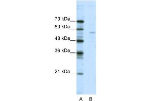 WB Suggested Anti-ELK1 Antibody Titration:  2. (ELK1 Antikörper  (N-Term))