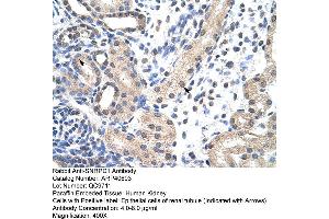 Rabbit Anti-SNRPD1 Antibody  Paraffin Embedded Tissue: Human Kidney Cellular Data: Epithelial cells of renal tubule Antibody Concentration: 4. (SNRPD1 Antikörper  (N-Term))