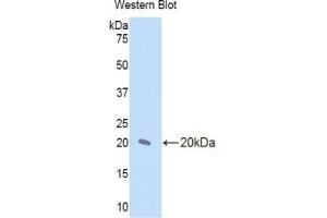 Detection of Recombinant IL17RD, Human using Polyclonal Antibody to Interleukin 17 Receptor D (IL17RD) (IL17RD Antikörper  (AA 157-299))