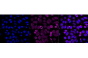 Immunocytochemical staining of HepG2 cells with Cyclin dependent kinase 1 antibody (ABIN7798205), 1:1,000).