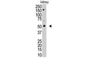 The RNF216 polyclonal antibody  is used in Western blot to detect RNF216 in mouse kidney tissue lysate. (RNF216 Antikörper  (C-Term))
