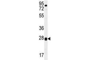 TOR2A antibody western blot analysis in human placenta tissue lysate. (TOR2A Antikörper  (AA 194-221))