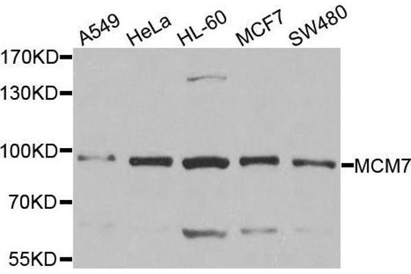 MCM7 抗体  (AA 360-719)