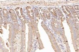 Immunohistochemistry (Paraffin-embedded Sections) (IHC (p)) image for anti-NCK Associated Protein 1 (NCKAP1) antibody (ABIN7074784)