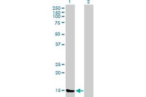 Western Blot analysis of TXNL4B expression in transfected 293T cell line by TXNL4B MaxPab polyclonal antibody. (TXNL4B Antikörper  (AA 1-149))