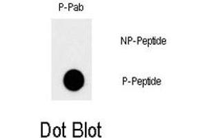 Dot blot analysis of MYC (phospho T58) polyclonal antibody  on nitrocellulose membrane. (c-MYC Antikörper  (pThr58))