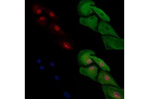 ABIN7094707 and ABIN7098758 staining  cells by IF/ICC. (HAND2 Antikörper  (Internal Region))